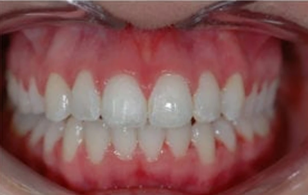 second image